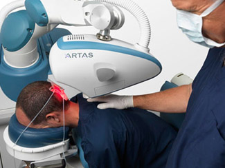 Przeszczep włosów za pomocą robota ARTAS